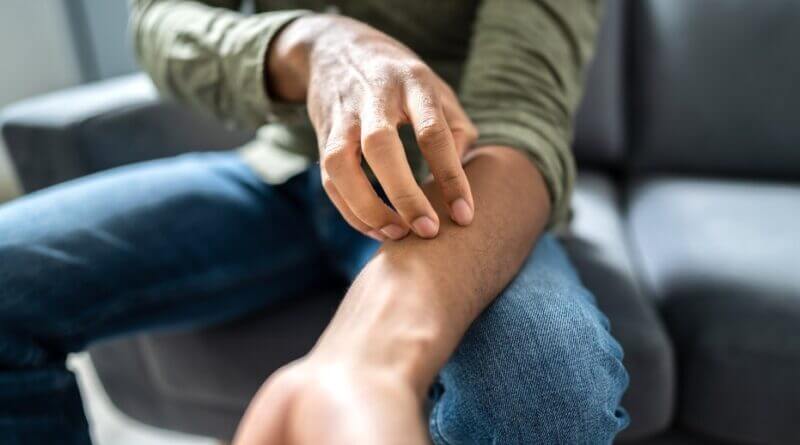 Minnesota confirms outbreak of sexually transmitted fungal infection State confirms outbreak of sexually transmitted fungal infection, experts urge caution