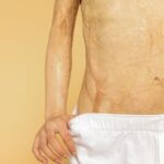 Patient with burns to 96% of body discharged from Mississippi burn center Photo by Polina Tankilevitch on Pexels